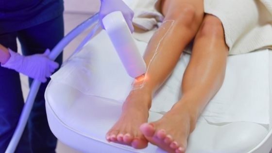 Does laser hair removal hurt?