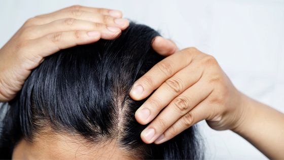 Why does my scalp hurt when I move my hair?